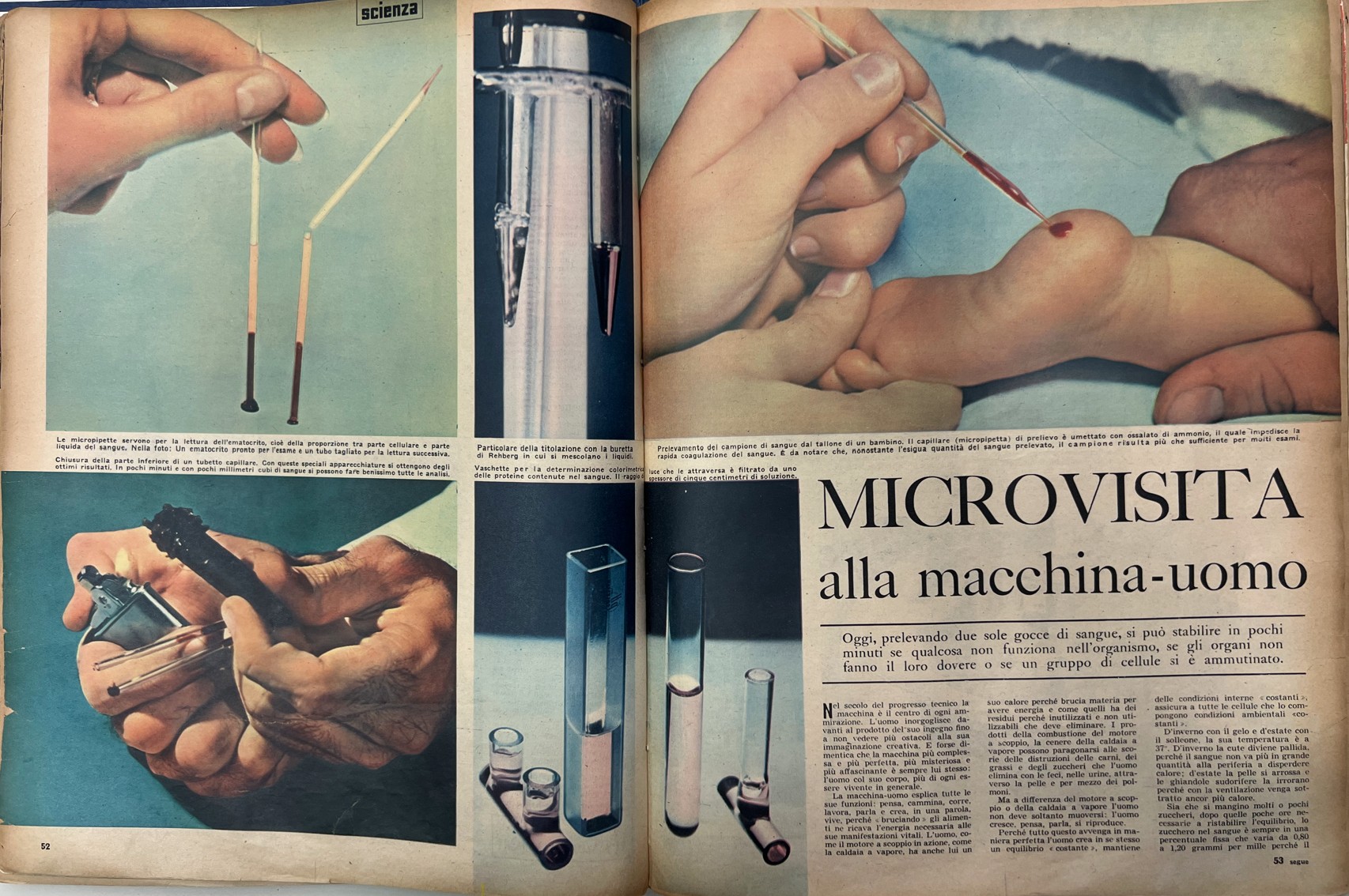 Microvisita alla macchina-uomo