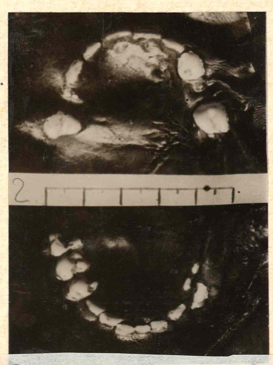 Riproduzione fotografica delle impronte su plastilina della dentatura di Rosa Vercesi